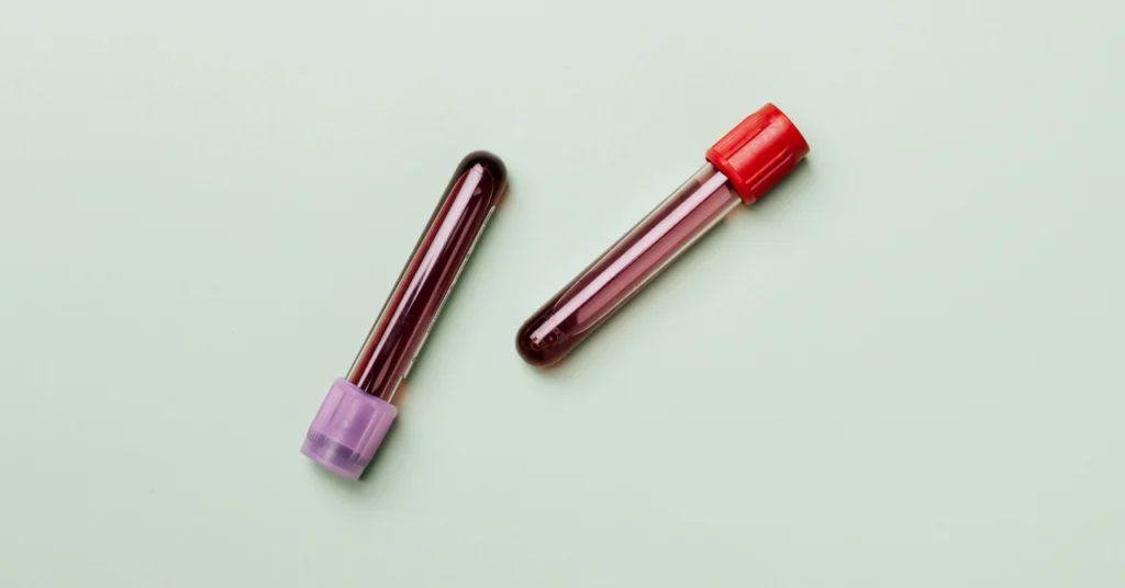 tipo sanguíneo alzheimer