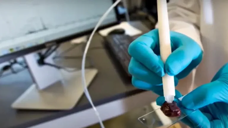 Caneta - detecta câncer