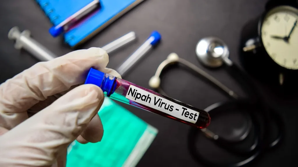 Nipah - vírus