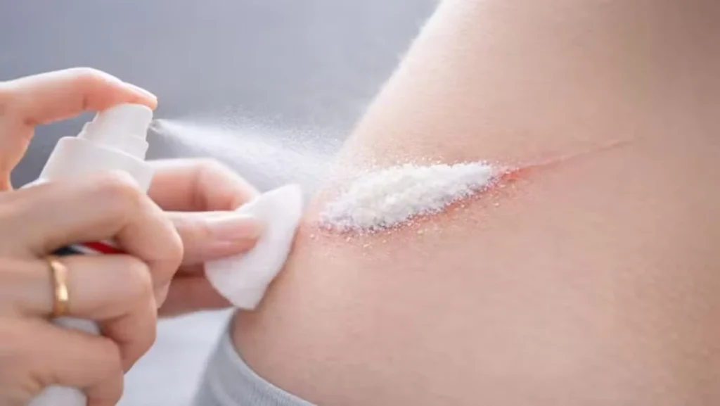 spray hemostático